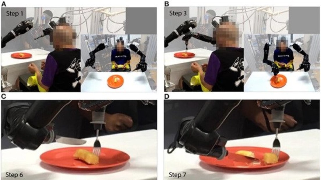 Dos brazos robóticos permiten a una persona parcialmente paralizada comer por sí misma después de 30 años