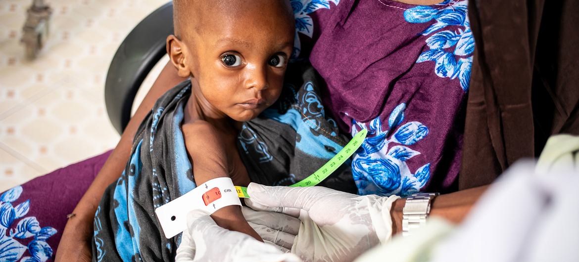 Un nuevo niño sufre malnutrición grave cada minuto en 15 países, advierte UNICEF