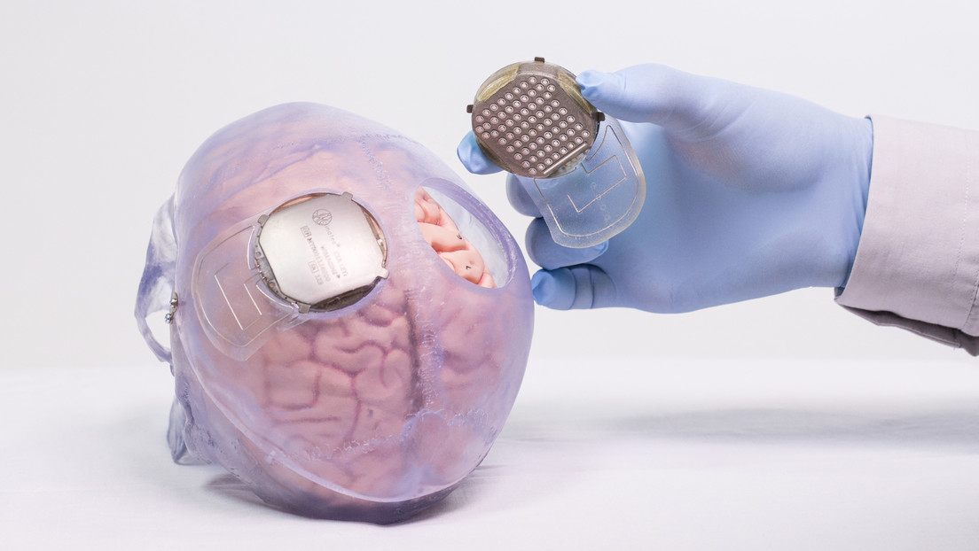 Un rival de Neuralink completa el primer implante humano de interfaz cerebro-ordenador en EE.UU.